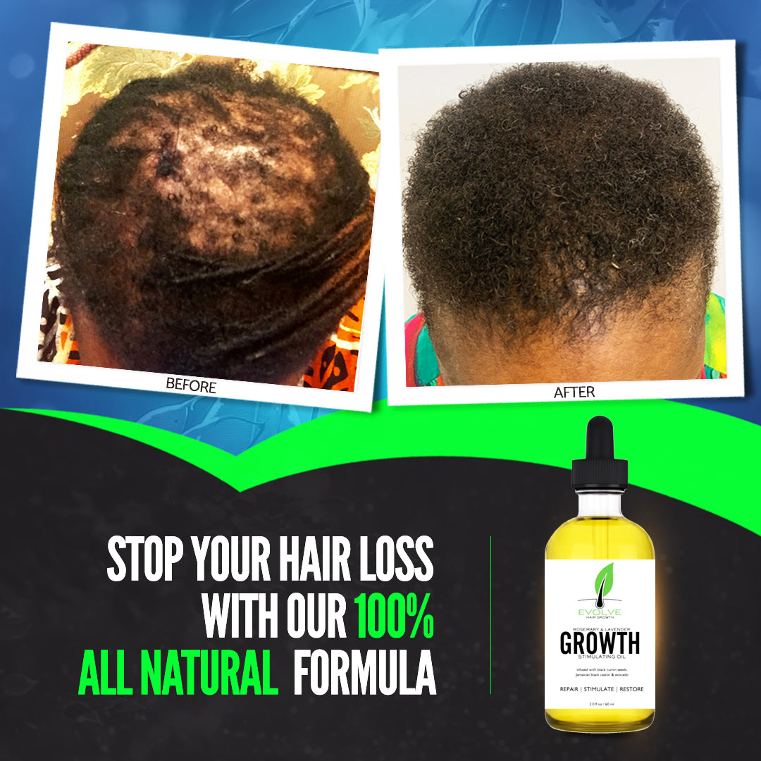 Evolve Hair Growth Oil