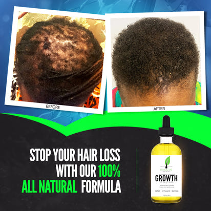 Evolve Hair Growth Oil