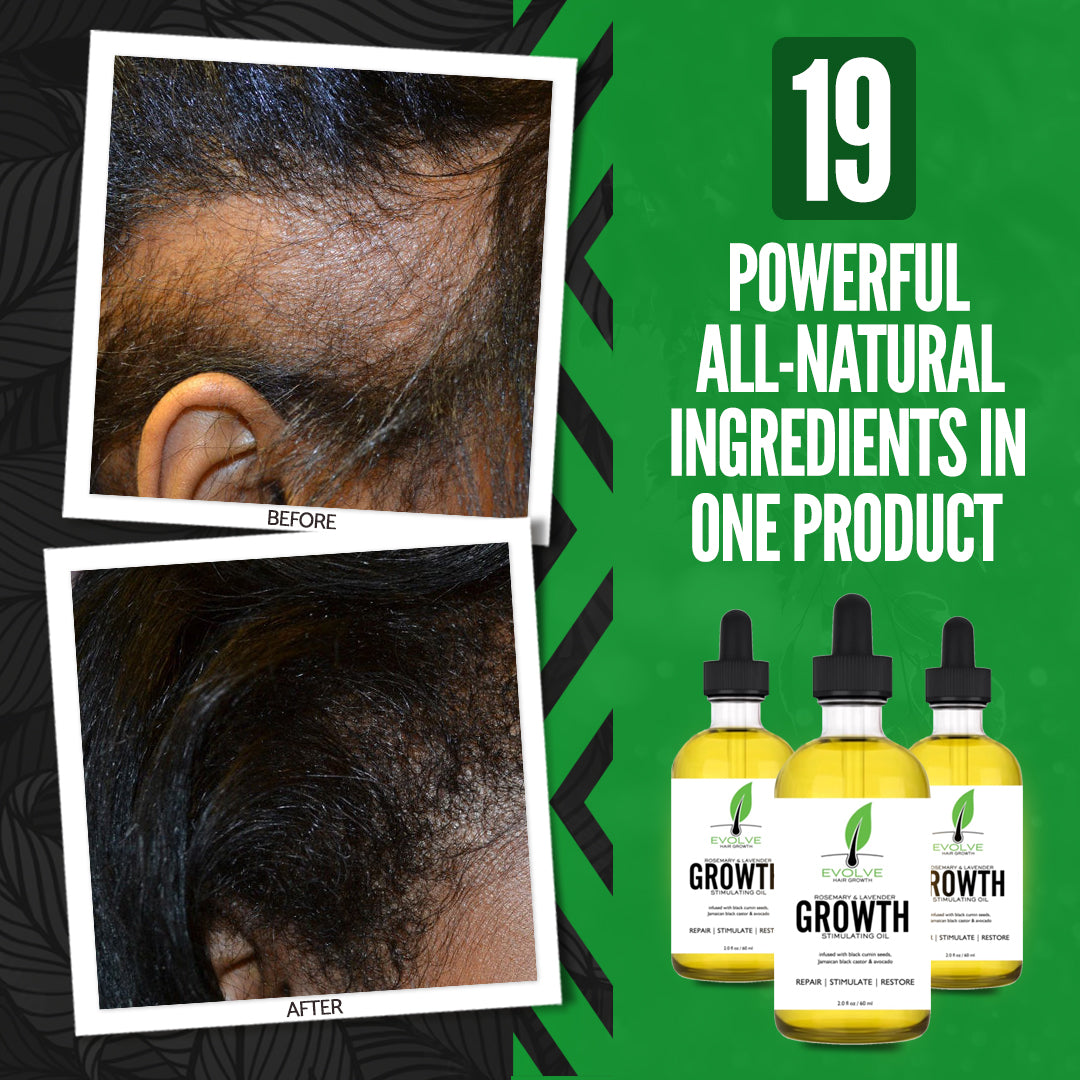 Evolve Hair Growth Oil