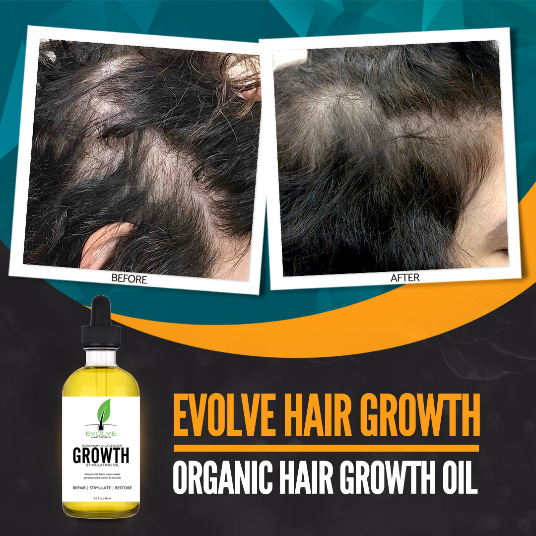 Evolve Hair Growth Oil