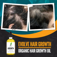 Evolve Hair Growth Oil
