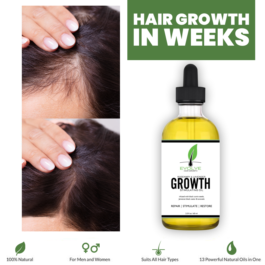 Evolve Hair Growth Oil