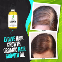Evolve Hair Growth Oil